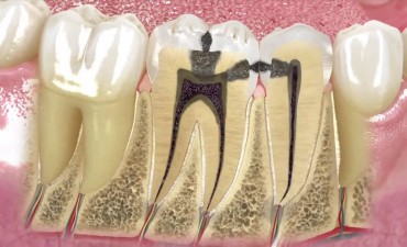 Endodontics