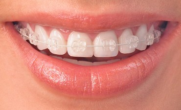 Orthodontics