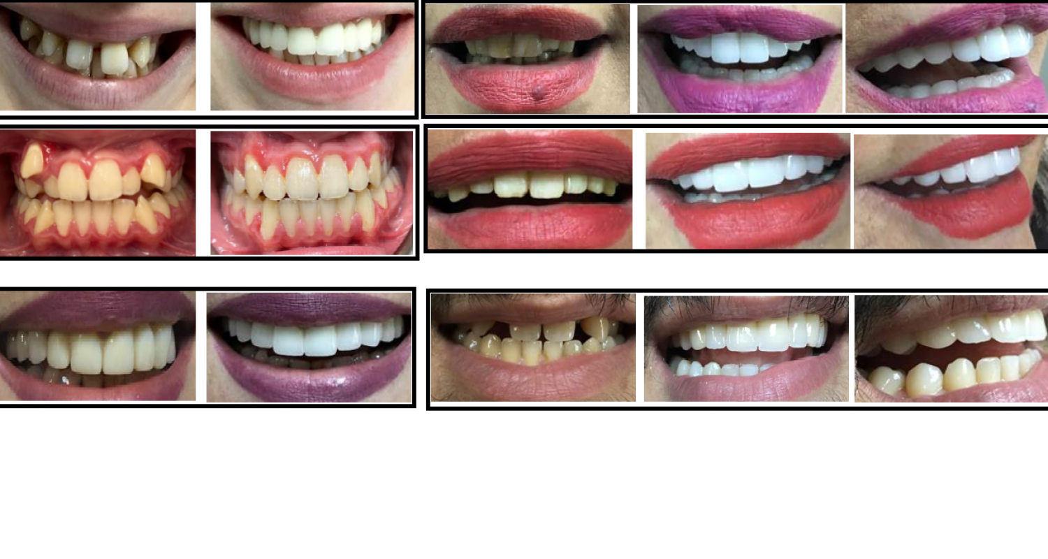 Before and After Treatment 
