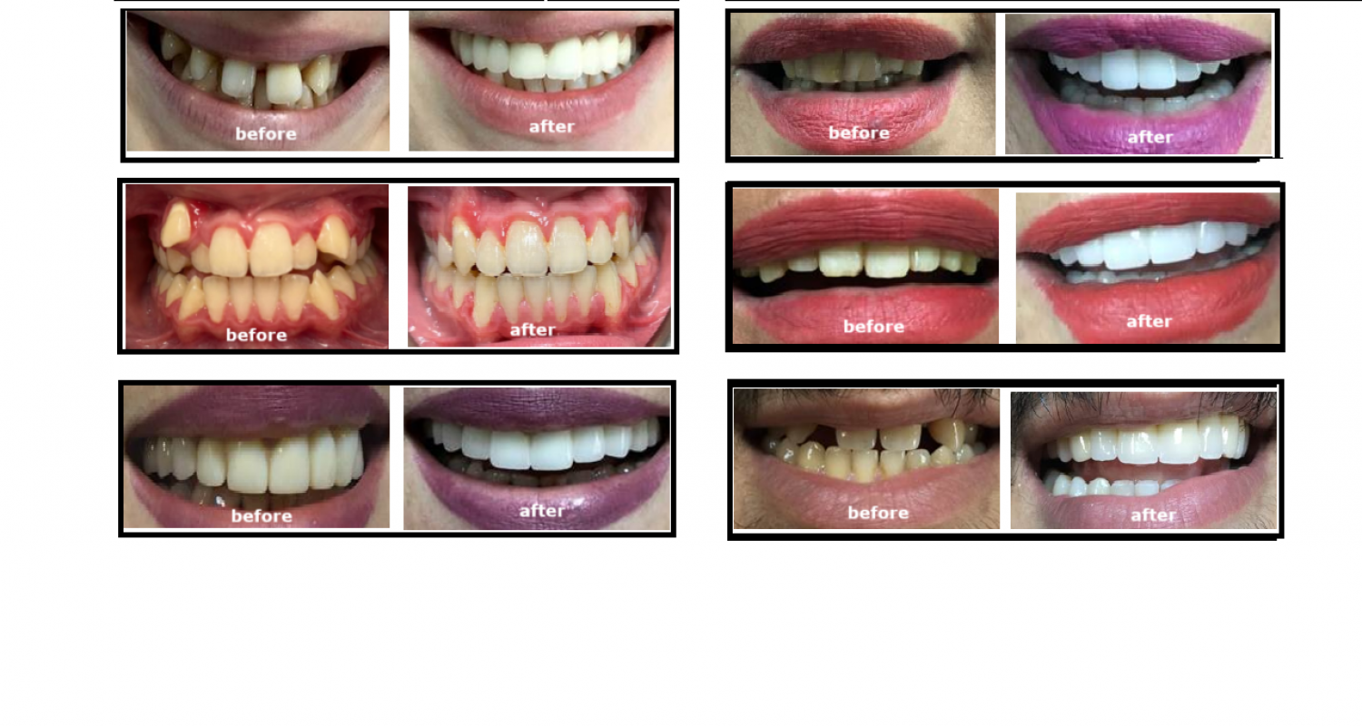 Before and After Treatment  