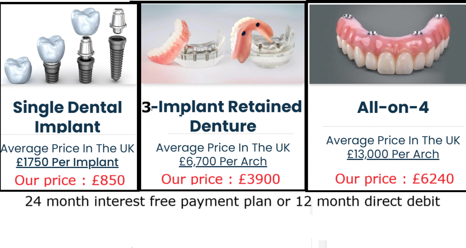 Implant treatment options