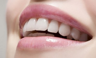 Dental Esthetics